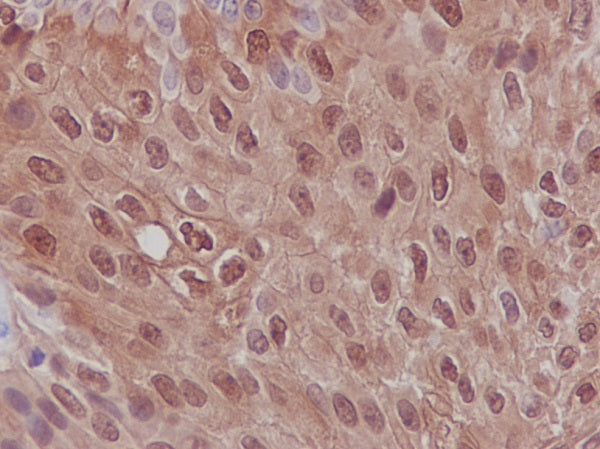 Anti-S100P Rabbit Monoclonal Antibody