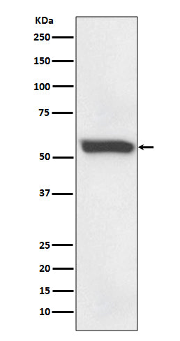 Anti-FTCD Rabbit Monoclonal Antibody