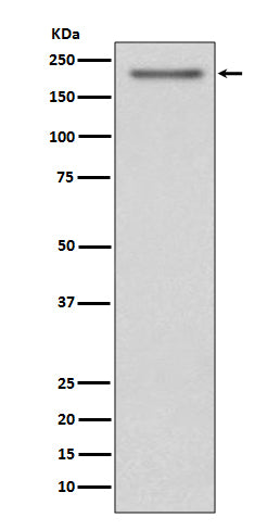 Anti-PDGFR alpha Rabbit Monoclonal Antibody