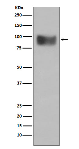 Anti-Interferon alpha/beta Receptor 1 Rabbit Monoclonal Antibody
