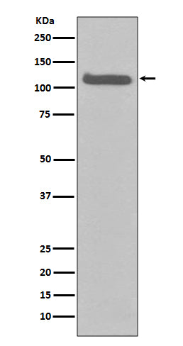 Anti-FGFR3 Rabbit Monoclonal Antibody
