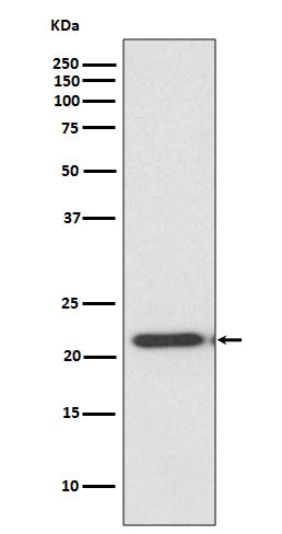 Anti-Metalloproteinase Inhibitor 2 Rabbit Monoclonal Antibody