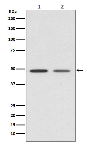 Anti-Vitamin D3 Receptor Rabbit Monoclonal Antibody
