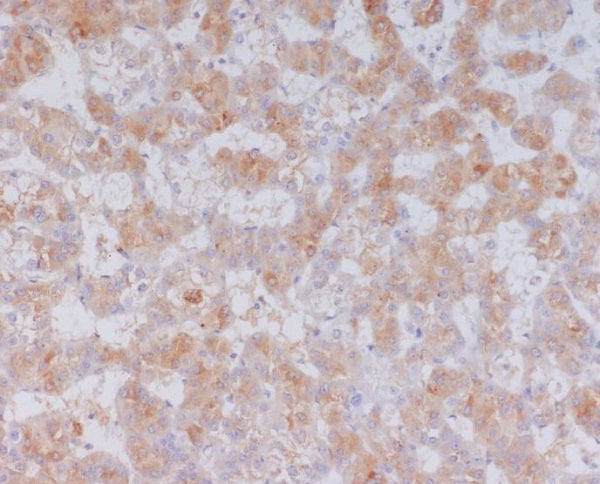 Anti-Serum Amyloid A Rabbit Monoclonal Antibody