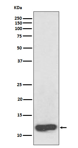 Anti-Serum Amyloid A Rabbit Monoclonal Antibody