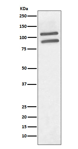 Anti-PML Protein Rabbit Monoclonal Antibody