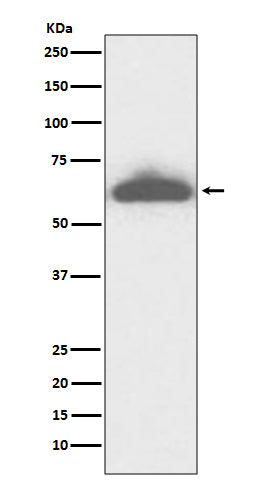 Anti-RPE65 Rabbit Monoclonal Antibody