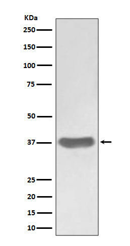 Anti-SFRP1 Rabbit Monoclonal Antibody