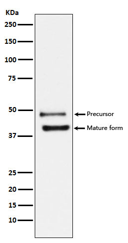 Anti-TNFRSF10B Rabbit Monoclonal Antibody