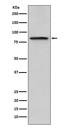 Anti-Periostin Rabbit Monoclonal Antibody