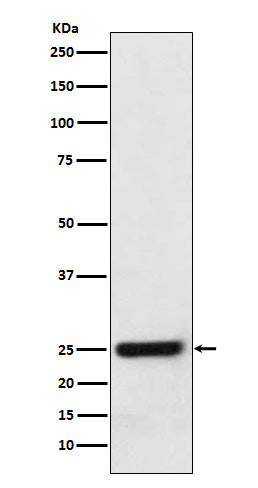 Anti-ERAB Rabbit Monoclonal Antibody