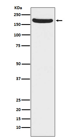 Anti-NMDAR2A Rabbit Monoclonal Antibody