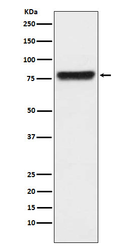 Anti-Plasma Kallikrein Rabbit Monoclonal Antibody