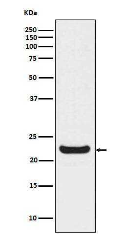 Anti-RBP4 Rabbit Monoclonal Antibody