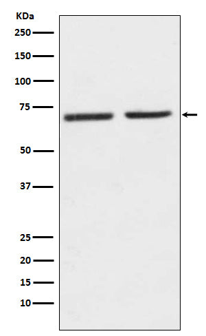 Anti-HTR2C Rabbit Monoclonal Antibody