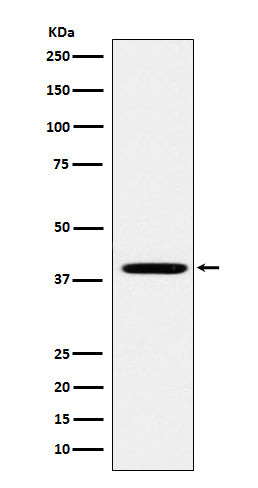 Anti-Folate Binding Protein Rabbit Monoclonal Antibody