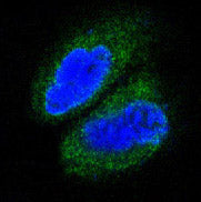 Anti-TAK1 Rabbit Monoclonal Antibody