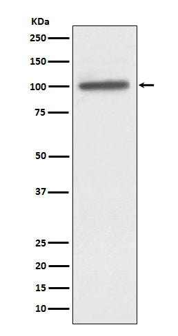 Anti-alpha Actinin 4 Rabbit Monoclonal Antibody