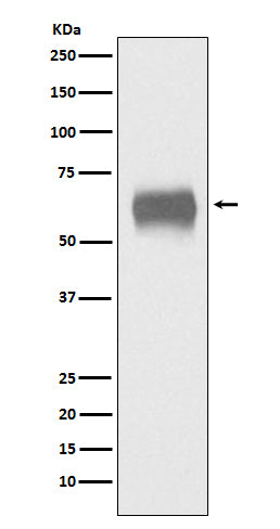 Anti-CD5 Rabbit Monoclonal Antibody