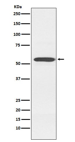 Anti-Cytochrome P450 2D6 Rabbit Monoclonal Antibody