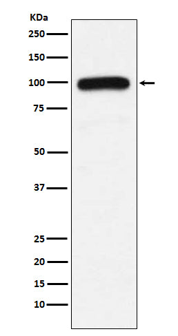 Anti-Ubiquitin Protein Ligase E3A Rabbit Monoclonal Antibody