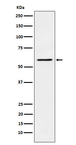 Anti-PAK1 Rabbit Monoclonal Antibody