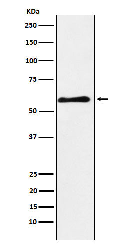 Anti-PAK3 Rabbit Monoclonal Antibody