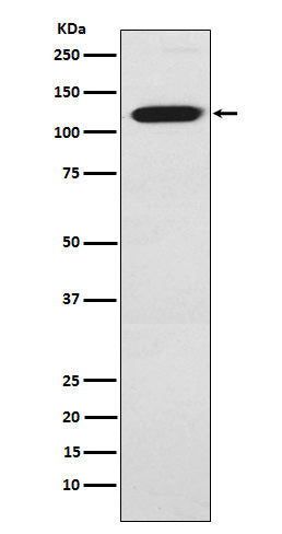 Anti-Ctip1 Rabbit Monoclonal Antibody