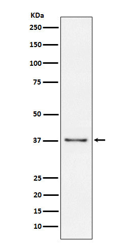 Anti-CD23 Rabbit Monoclonal Antibody