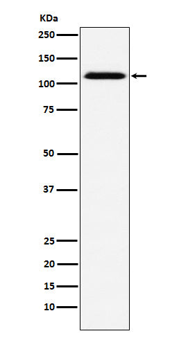 Anti-CD30 Rabbit Monoclonal Antibody
