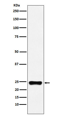Anti-BAG2 Rabbit Monoclonal Antibody