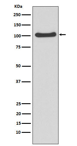 Anti-MVP Rabbit Monoclonal Antibody