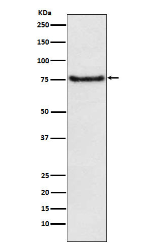 Anti-BDKRB2 Rabbit Monoclonal Antibody