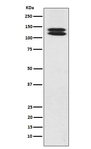 Anti-H Cadherin Rabbit Monoclonal Antibody