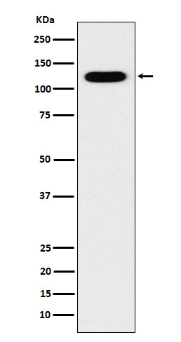 Anti-Cadherin 16 Rabbit Monoclonal Antibody