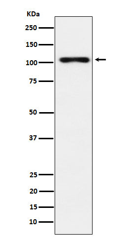 Anti-Thyroid Peroxidase Rabbit Monoclonal Antibody