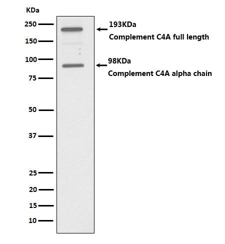 Anti-C4A Rabbit Monoclonal Antibody