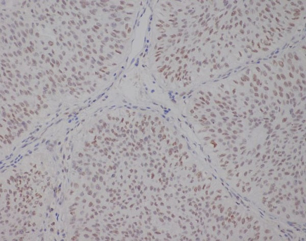 Anti-Transcription Factor E3 Rabbit Monoclonal Antibody