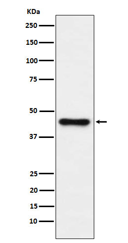 Anti-ABHD5 Rabbit Monoclonal Antibody