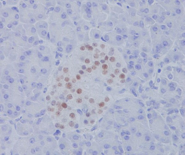 Anti-NKX2.2 Rabbit Monoclonal Antibody