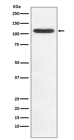 Anti-HIP1 Rabbit Monoclonal Antibody