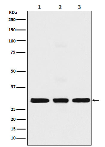 Anti-Histone H1.2 Rabbit Monoclonal Antibody