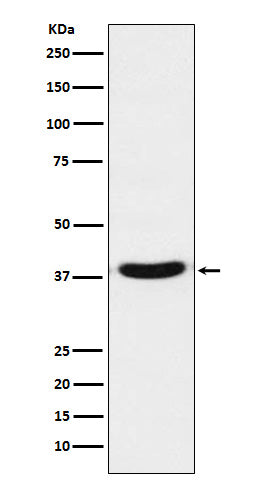 Anti-VPS26 Rabbit Monoclonal Antibody
