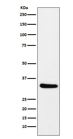 Anti-CRALBP Rabbit Monoclonal Antibody
