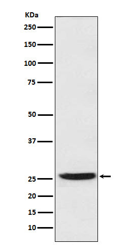 Anti-15 PGDH Rabbit Monoclonal Antibody