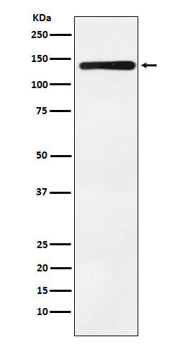 Anti-BUB1 Rabbit Monoclonal Antibody