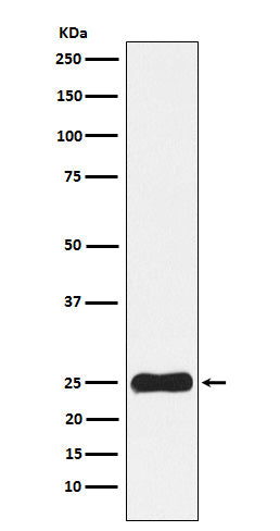 Anti-Casein Kinase 2 beta Rabbit Monoclonal Antibody