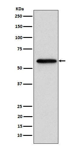 Anti-Retinoic Acid Receptor beta Rabbit Monoclonal Antibody