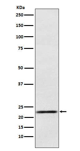 Anti-Prolactin Rabbit Monoclonal Antibody