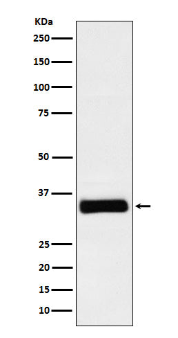 Anti-IGFBP2 Rabbit Monoclonal Antibody